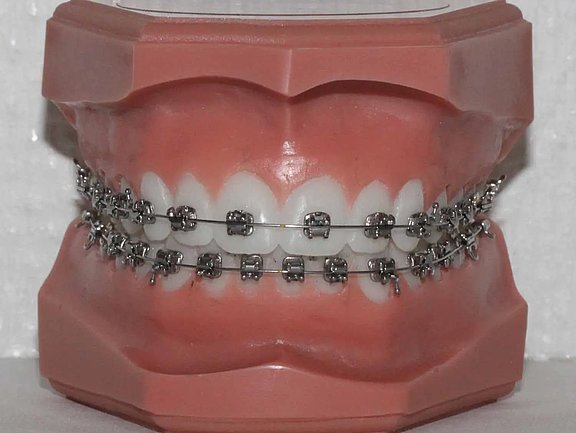Bracketsselbstligierend_254-1920w.jpg